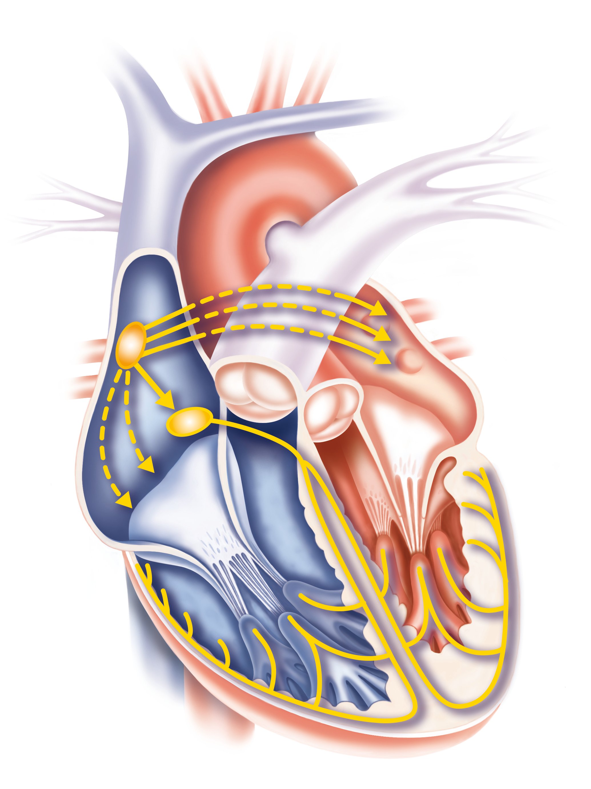 Hjärta genomskärning retledning.