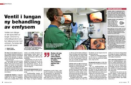 Lungventil ny behandling vid emfysem
