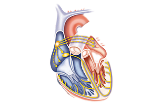 förmaksflimmer_puff kopiera.png