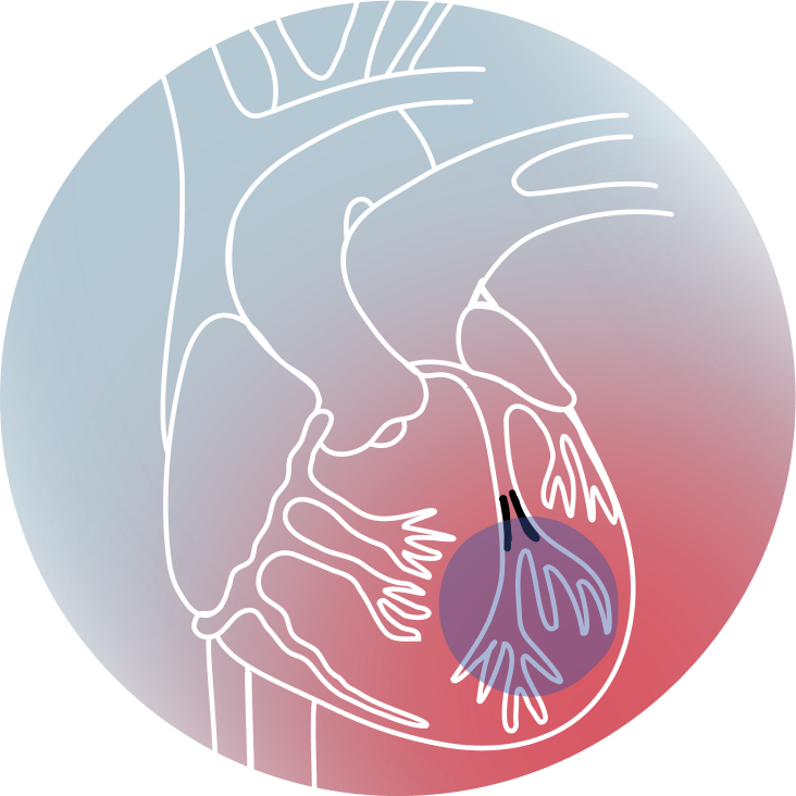 Hjärt- och kärlsjukdomar, symtom och behandling